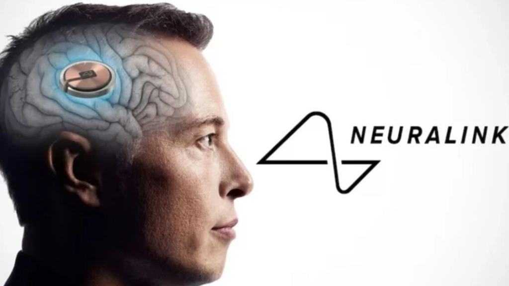 Chip otak Neuralink milik Elon Musk yang diuji ke manusia